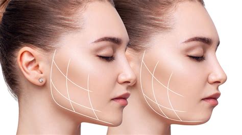 buccal fettpute|Buccal fat: Overview, removal process, cost, and more .